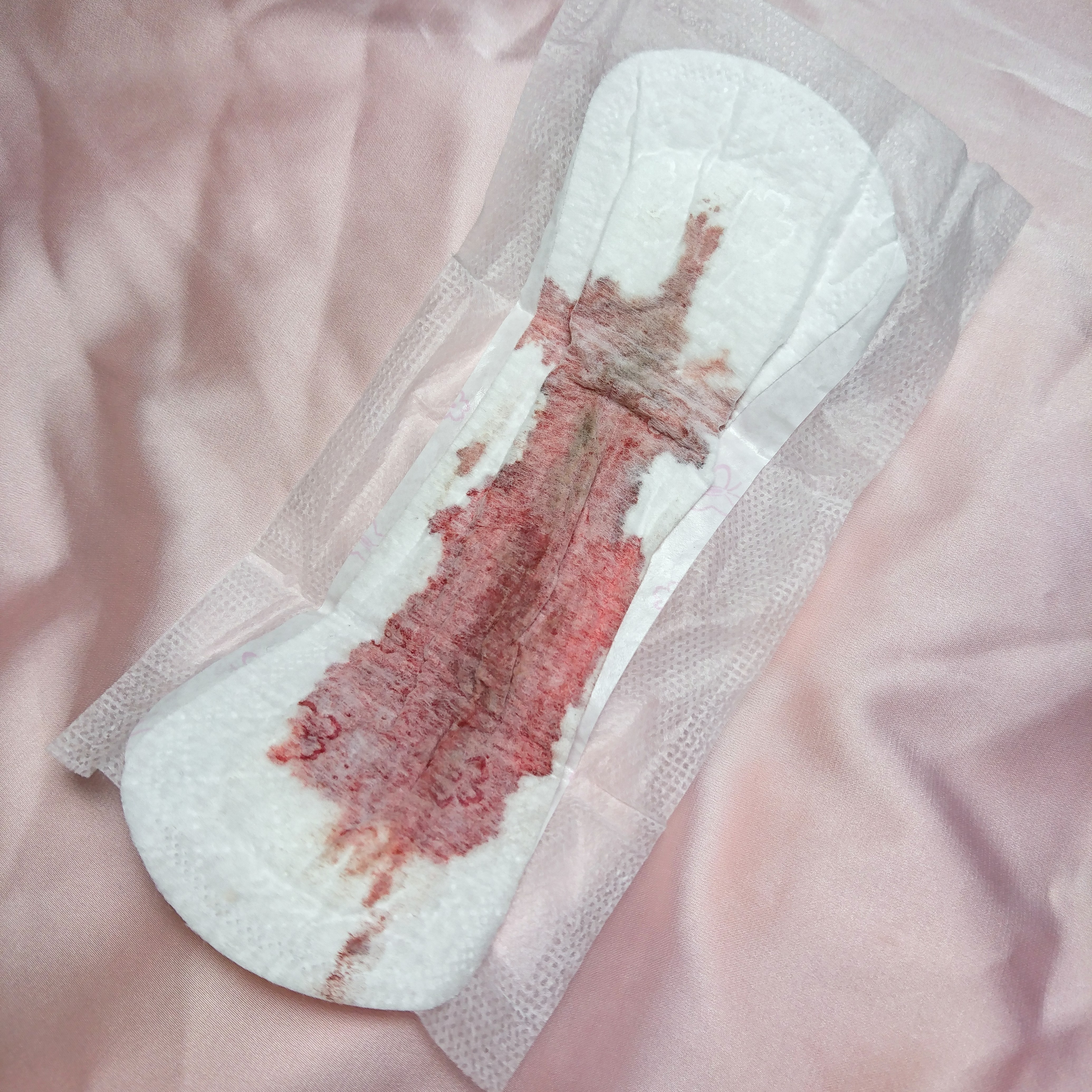 (ΦωΦ) 小貓貓月經來了~ 護墊-5 (ΦωΦ)