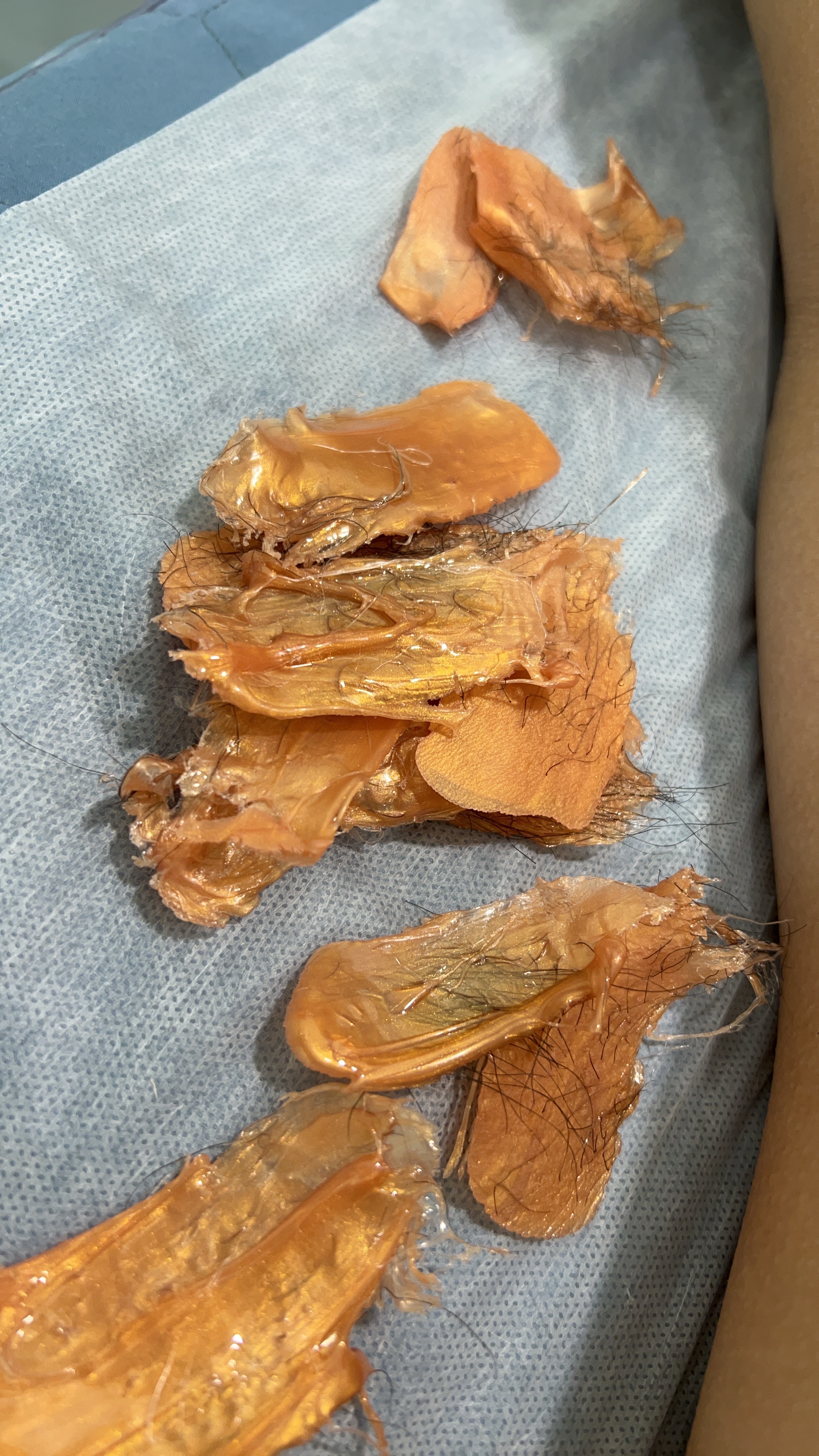 大一生的熱蠟除毛片