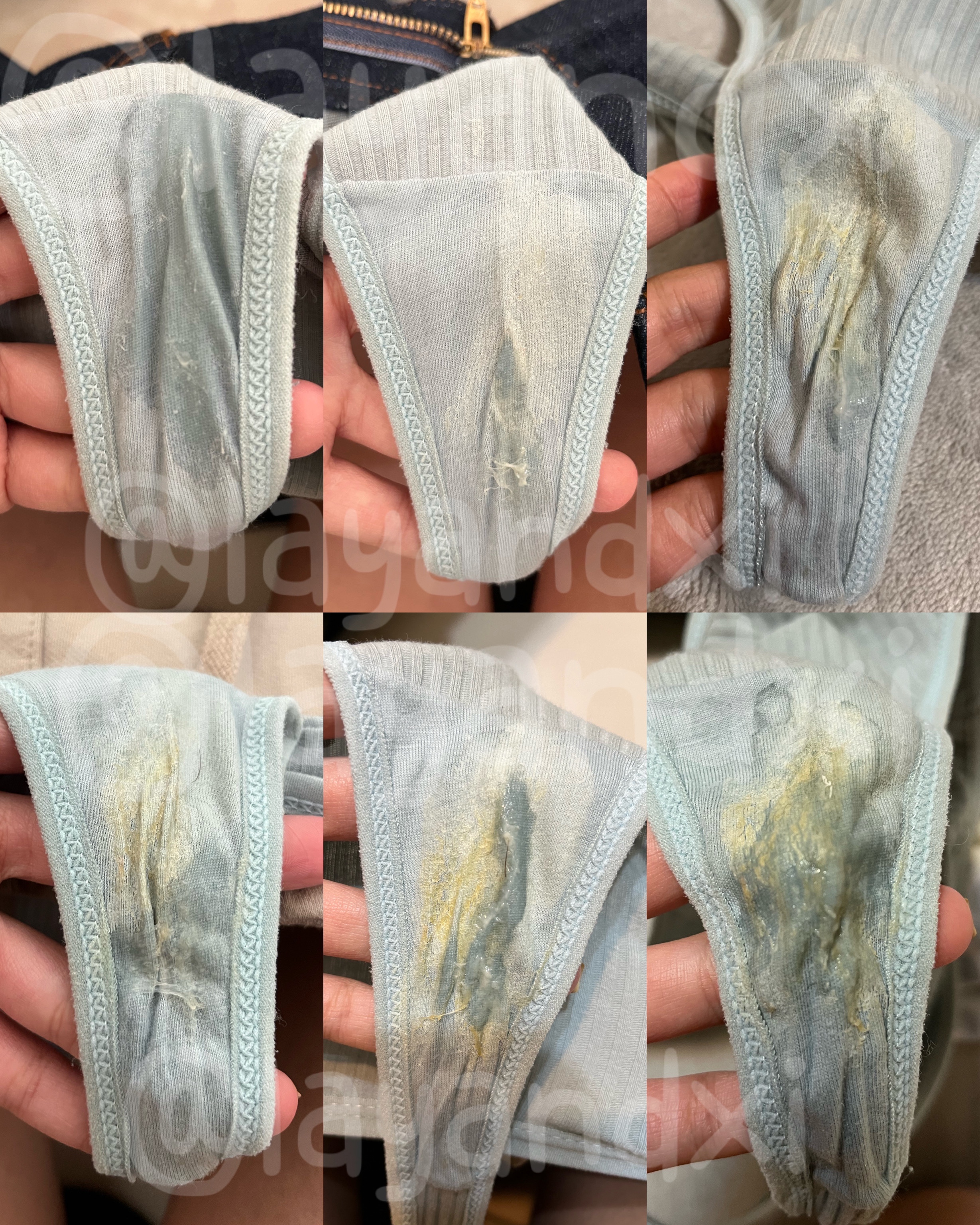 兩日排卵期分泌物參考